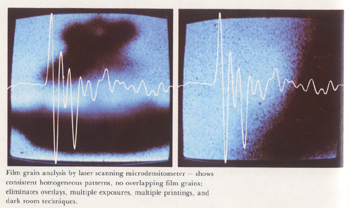 Analyse du grain des négatifs à la microdensitométrie par scanner. Elle montre un motif de grains homogènes, aucun recouvrement de grains, ce qui élimine toute manipulation de superposition, expositions multiples ou impressions multiples et techniques en chambre noir pour fraude.